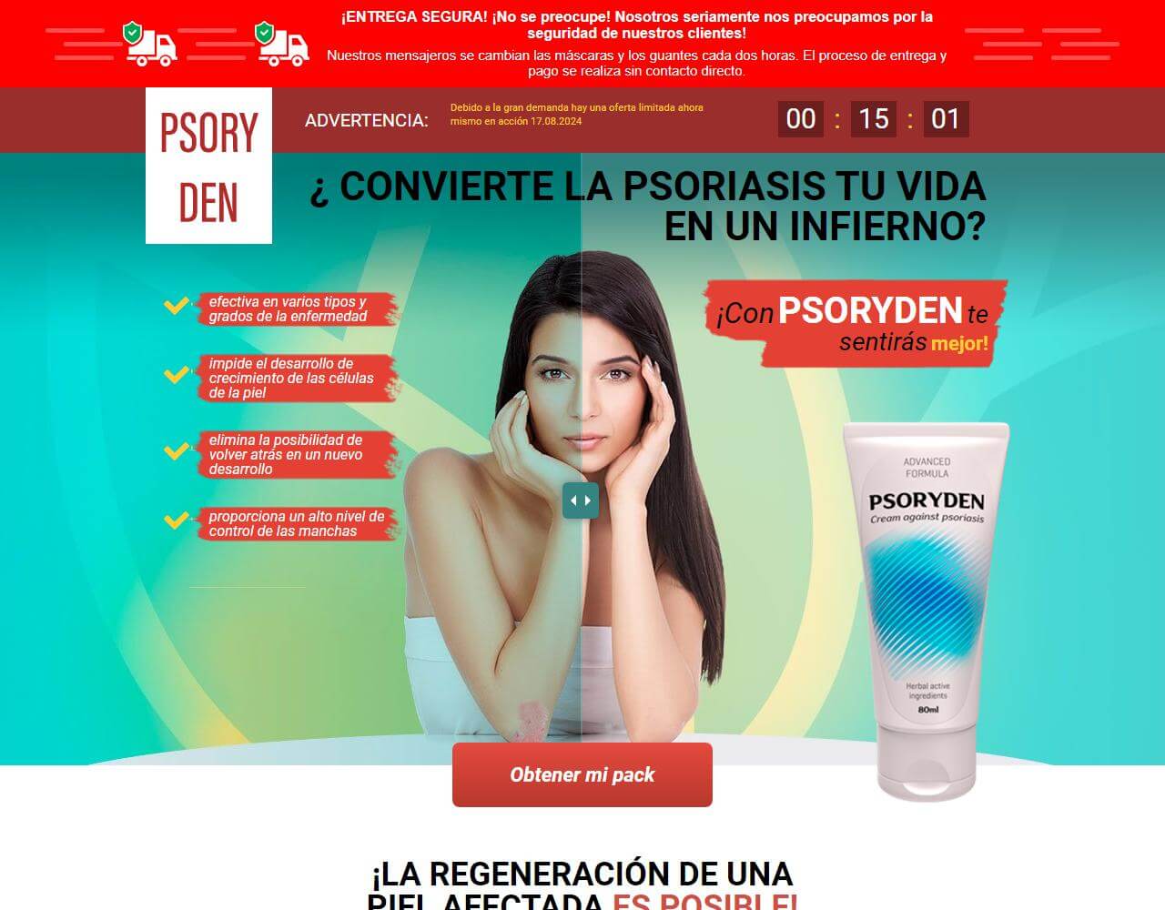 Psoryden 1